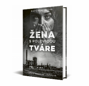 Žena s polovicou tváre